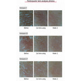 MEDICUBE Red Erasing Cream - LVS SHOP